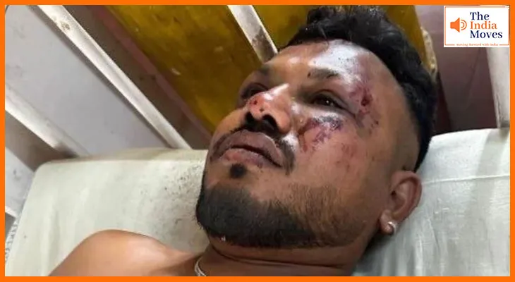 सीट समेत मैं बाहर गिर गया', रमेश विश्वास कुमार ने बताया प्लेन क्रैश में भी कैसे बचे जिंदा