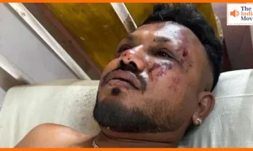 सीट समेत मैं बाहर गिर गया', रमेश विश्वास कुमार ने बताया प्लेन क्रैश में भी कैसे बचे जिंदा