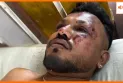 सीट समेत मैं बाहर गिर गया', रमेश विश्वास कुमार ने बताया प्लेन क्रैश में भी कैसे बचे जिंदा